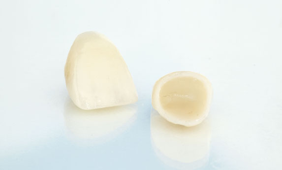 Why Are Porcelain Crowns Needed